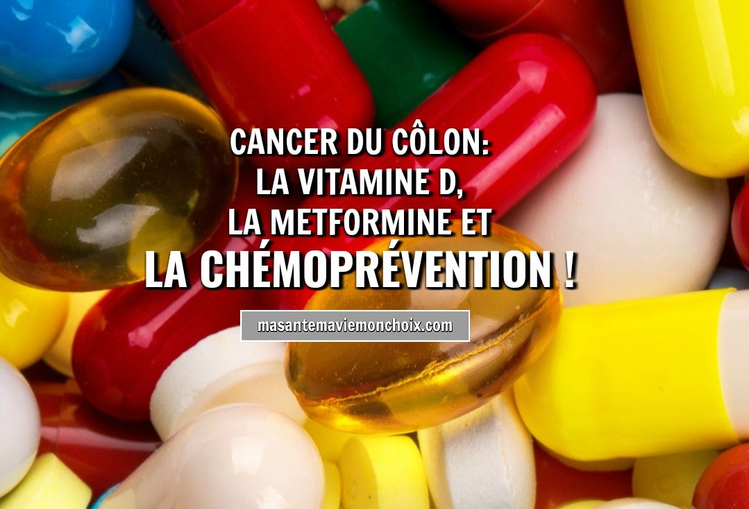 Photo drsuciu_vitamine_d_merformine_cancer_colon