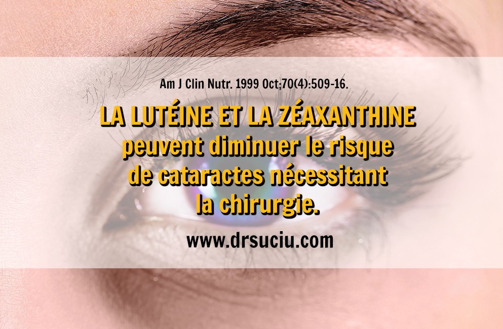 Photo La lutéine et la zéaxanthine en cas de cataractes - drsuciu