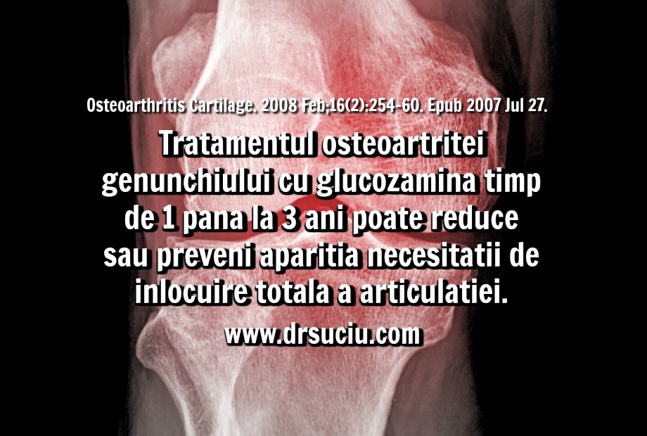 Photo Beneficiile glucozaminei in caz de artroza a genunchiului - drsuciu