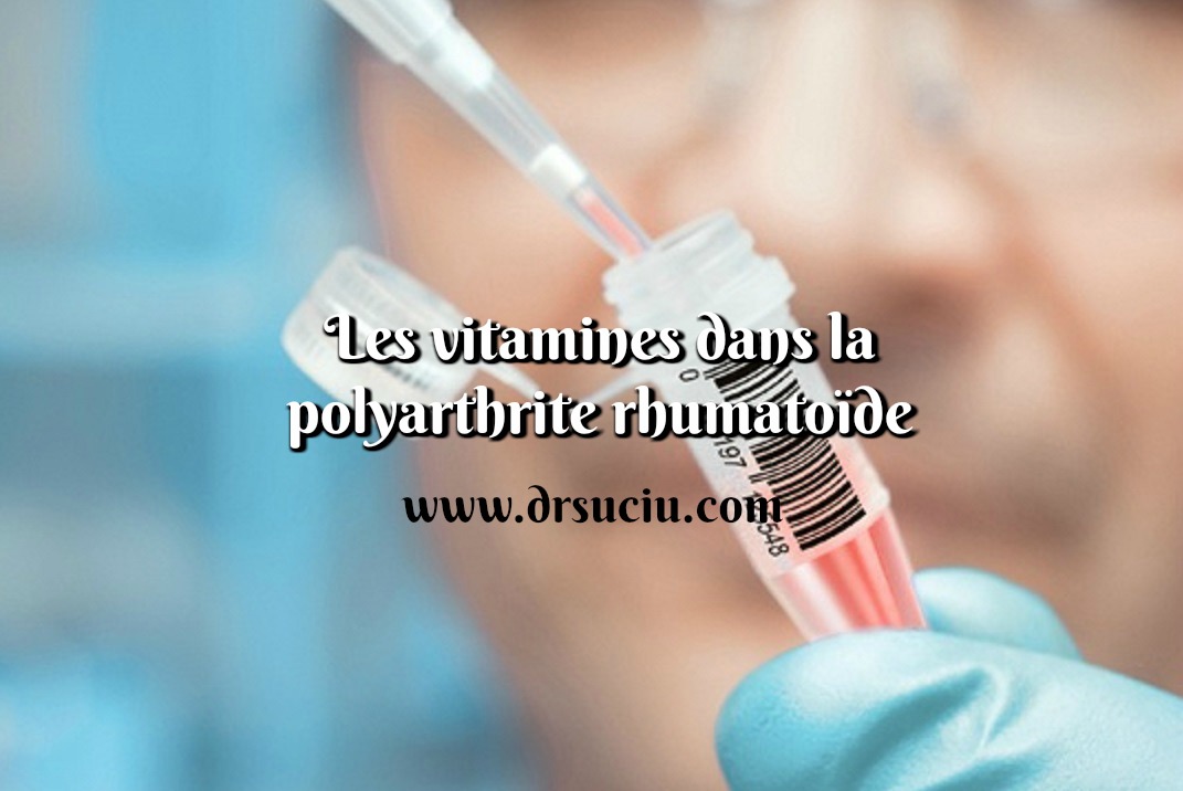 Photo drsuciu - vitamines - polyarthrite rhumatoïde 