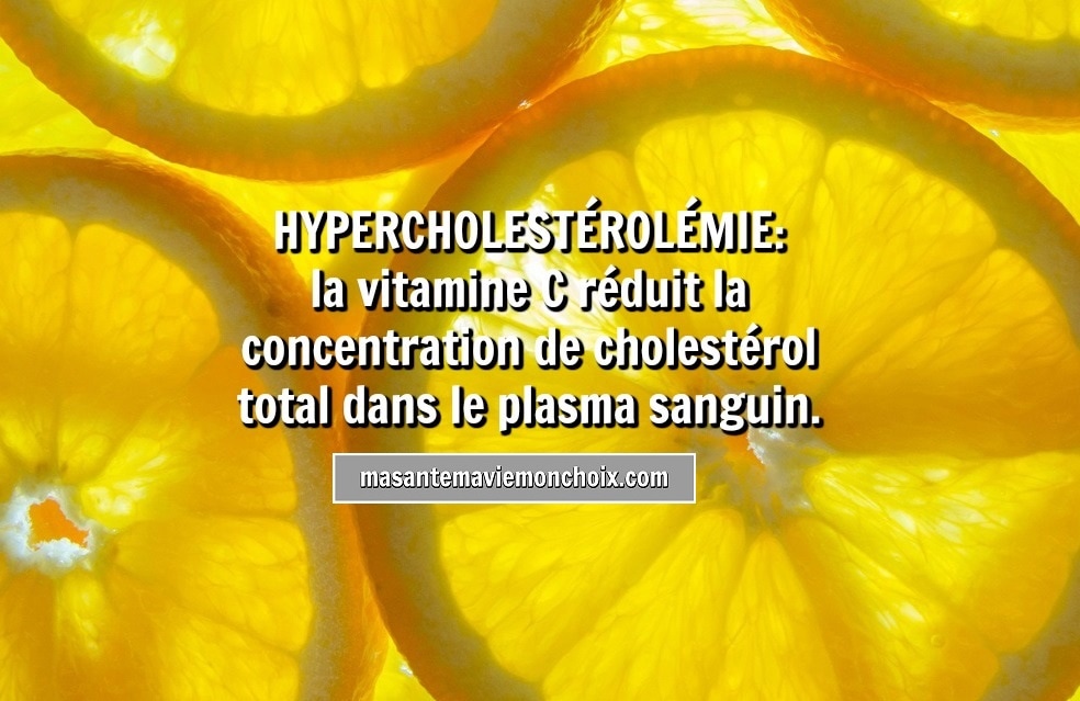 Photo drsuciu_vitamine_c_hypercholesterolemie