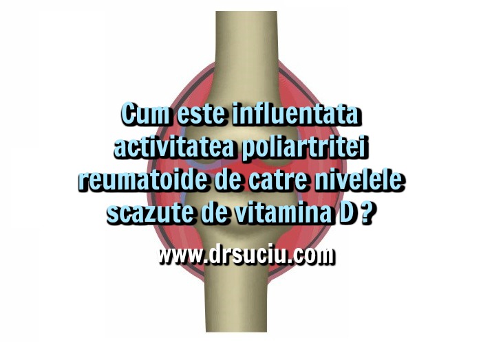 Photo drsuciu Influenta vitaminei D asupra poliartritei reumatoide