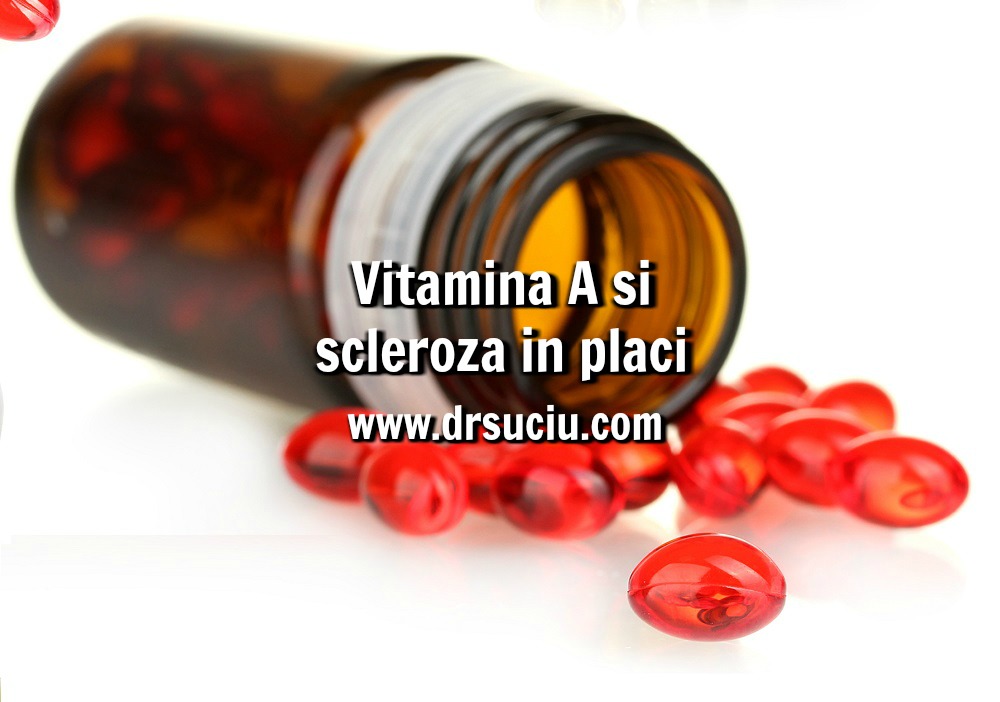 Photo drsuciu - Vitamina A si scleroza in placi