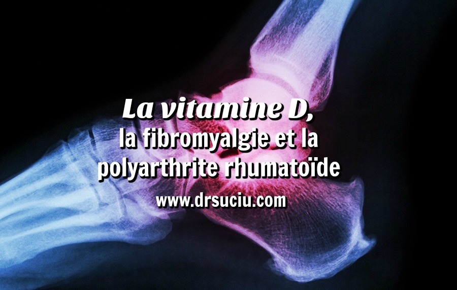 Photo drsuciu La vitamine D,  la fibromyalgie et la polyarthrite rhumatoïde